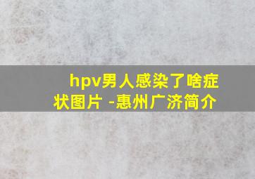 hpv男人感染了啥症状图片 -惠州广济简介